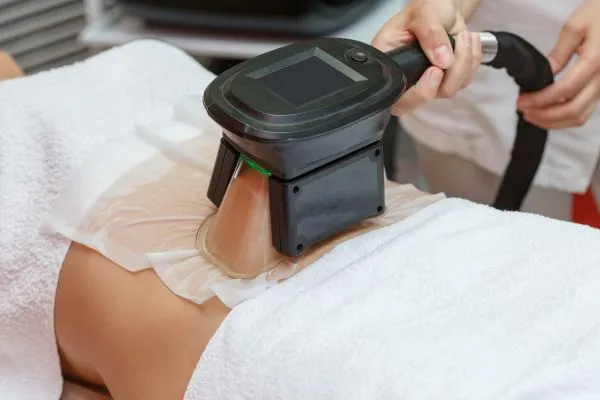 Image of person having fat freezing treatment to help weight gain Smethwick
