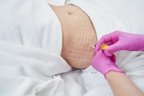 image of fat dissolving injections on love handles to help combat weight gain Smethwick