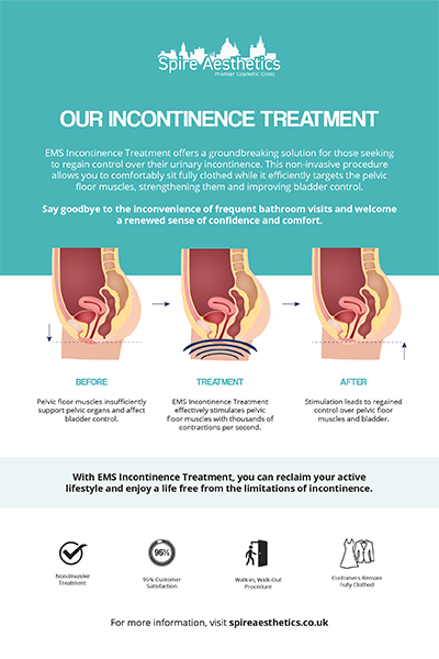 image of how urge incontinence Smethwick treatment works