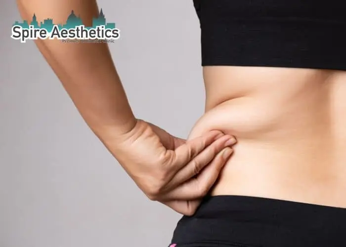 Image of woman pinching fat on their hips Smethwick. Fat Freezing treatment