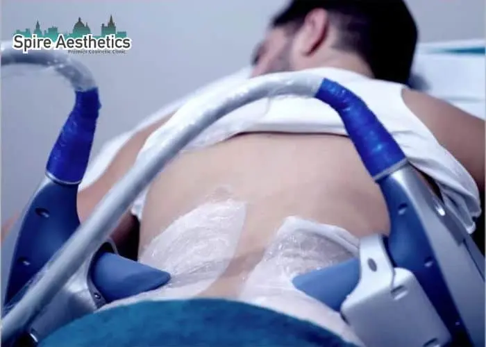 Man having fat freezing treatment done on love handles before a competitions Smethwick to create a sculpted look.