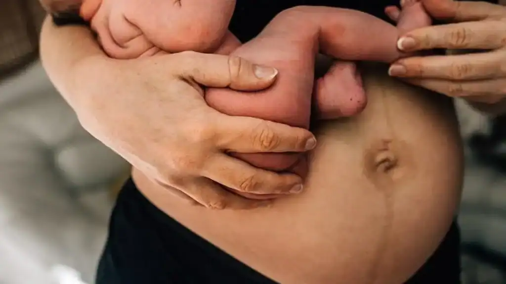 Why Is My Stomach Still Big After Pregnancy Smethwick?