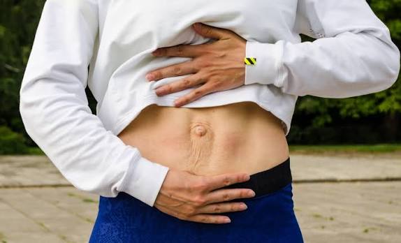 When Could Diastasis Recti Be the Missing Piece of the Puzzle Smethwick?